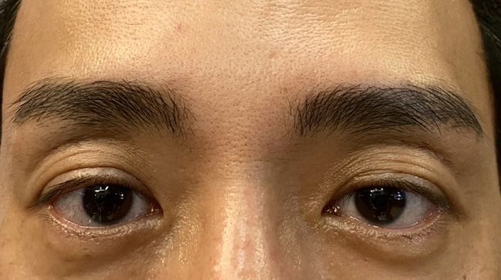 分享 #男士飄眉 有沒有眉毛真的差很多
