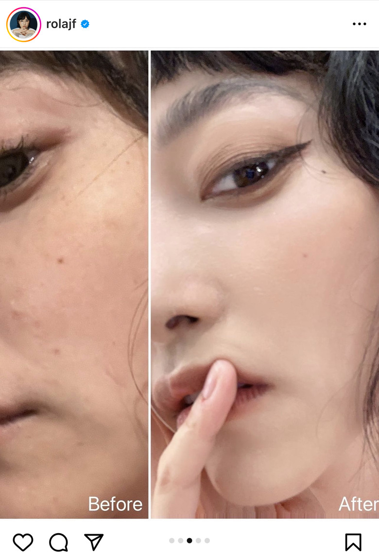 請問瑞絲朗速效水膜針 真實體驗？