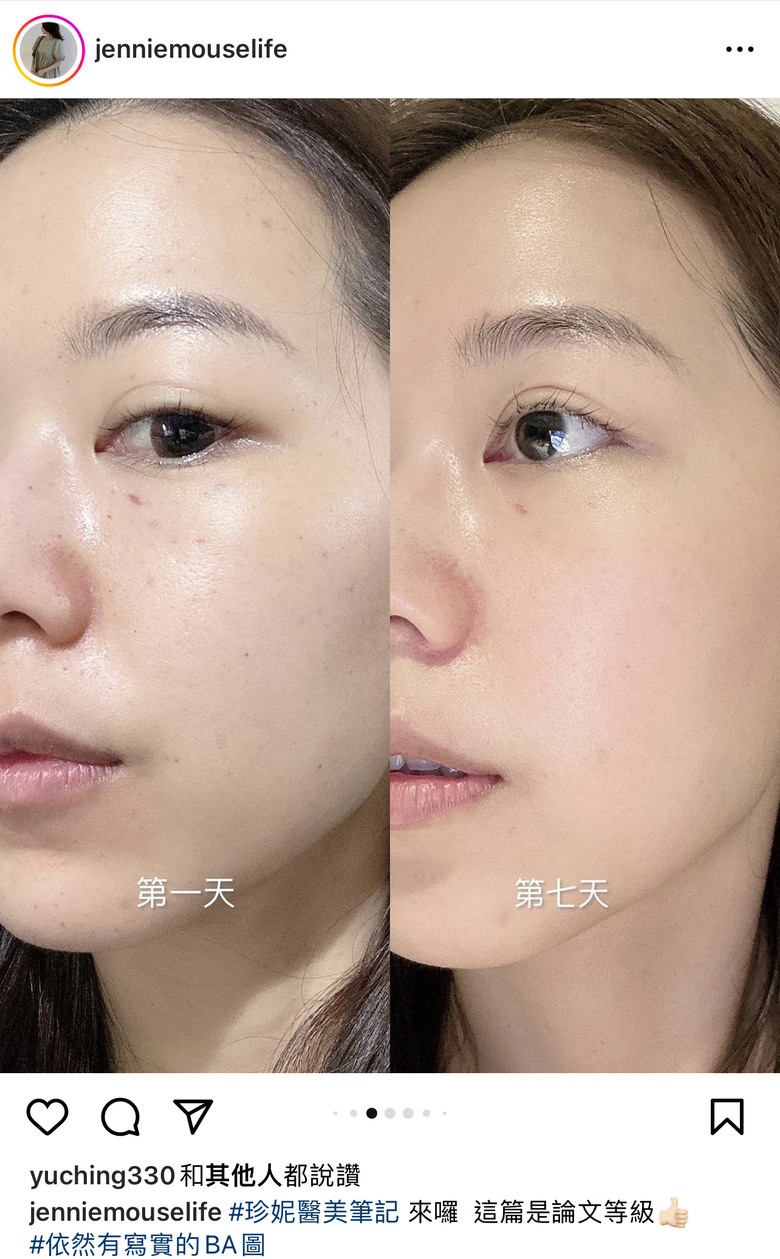 請問瑞絲朗速效水膜針 真實體驗？
