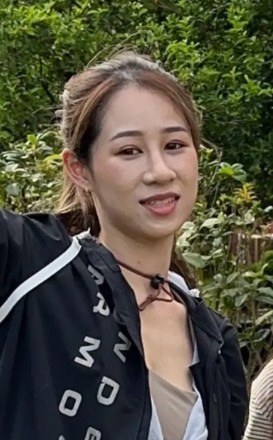 法令紋退散！後悔沒早點做 !