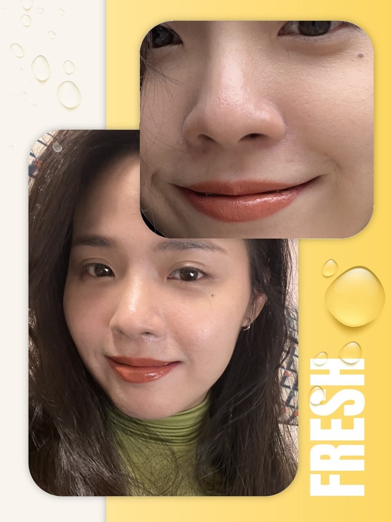 竹北醫美- 竹北鉑金美醫診所〰️蜂巢皮秒效果分享🐝 毛孔縮小真實體驗!