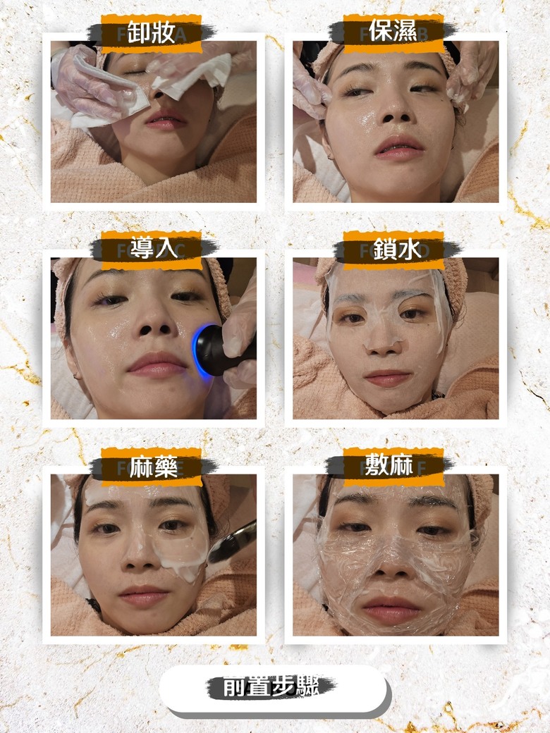 竹北醫美- 竹北鉑金美醫診所〰️蜂巢皮秒效果分享🐝 毛孔縮小真實體驗!