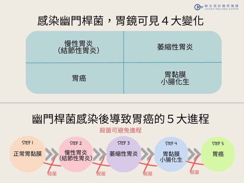 五大胃癌高風險族群注意 及早檢測幽門桿菌 遠離胃癌危險