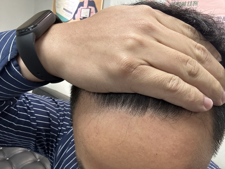 突破停滯期！入手旗艦型生髮帽心得分享