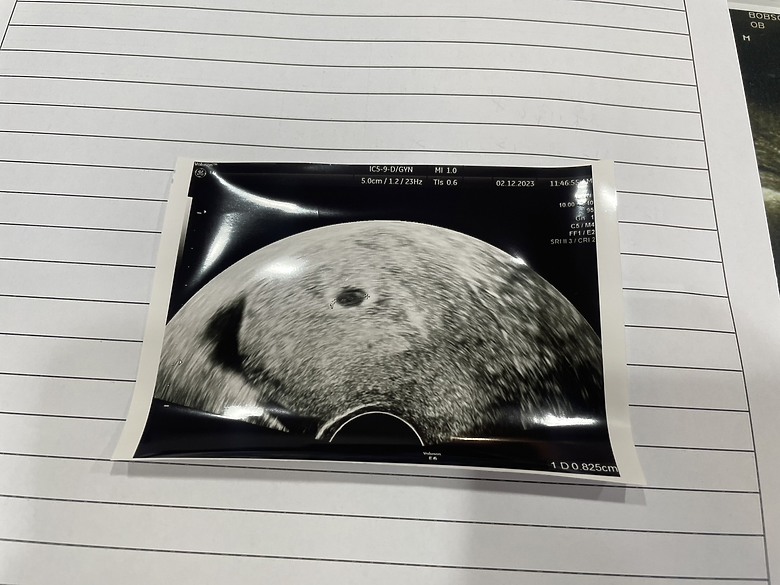 分享#年華40的孕期