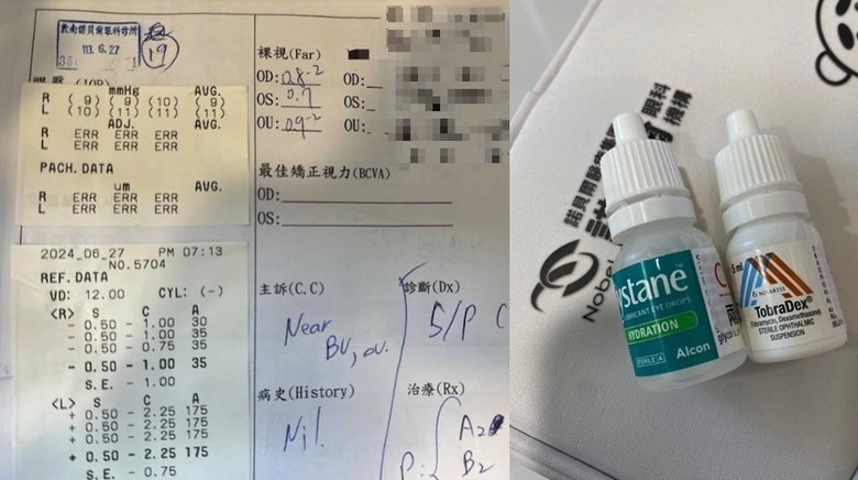 Smart pro 全飛秒雷後分享