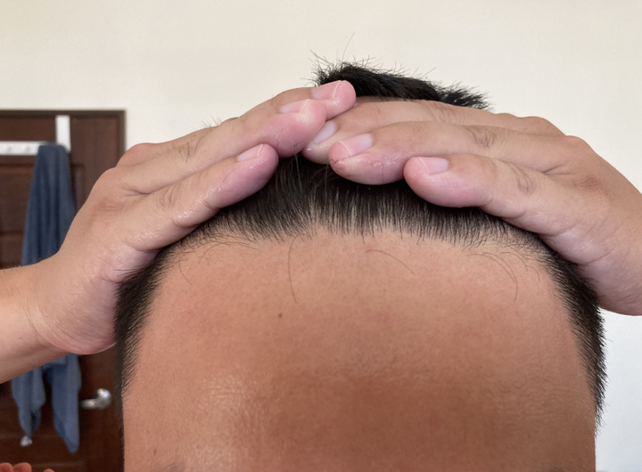 突破停滯期！入手旗艦型生髮帽心得分享