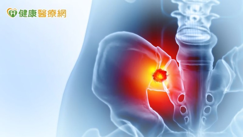 點我看大圖 多發性骨髓瘤治療再進化!「四合一療法」降低復發率、延長存活