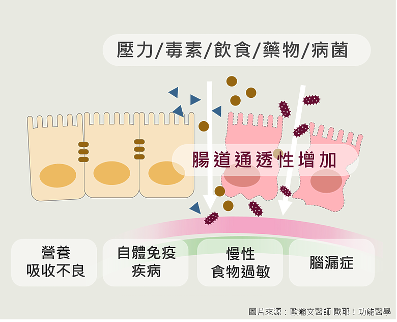 你有「腸漏症」嗎？2大檢測及早發現+5大程序修復腸道