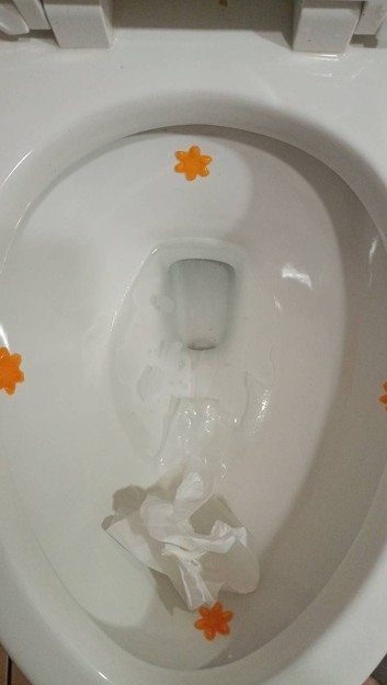 馬桶堵塞關於馬桶吸盤使用方法疑問