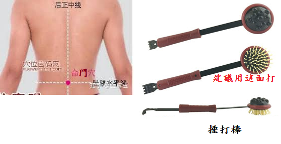 心絞痛