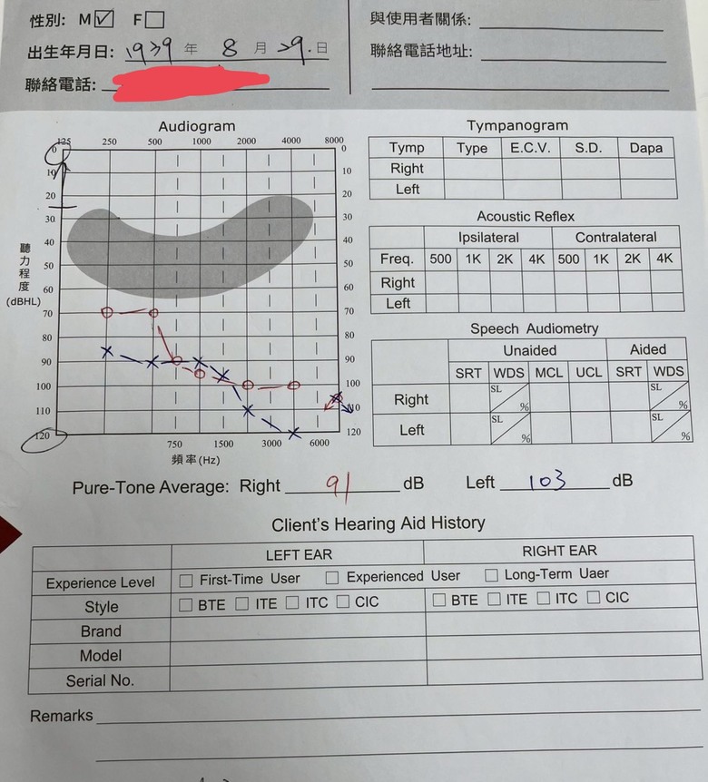 #分享 南港睿聲配助聽器心得