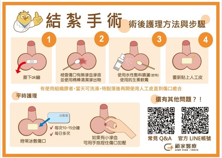 [分享] 母親節給老婆的禮物是成為顧家紮男！結紮手術經驗分享