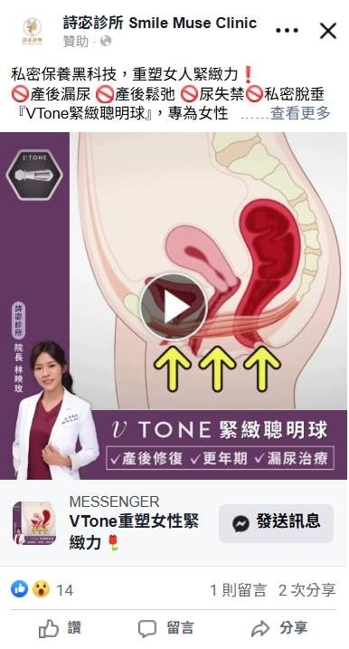 產後漏尿醫美建議