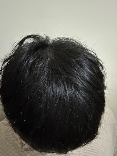 機車族改善頭皮搔癢的方法