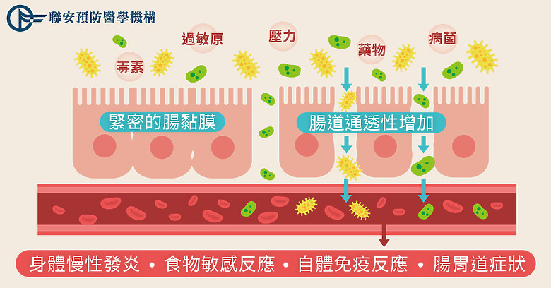 為什麼腹脹久治不癒?三大檢查+功能分析找出隱藏病因