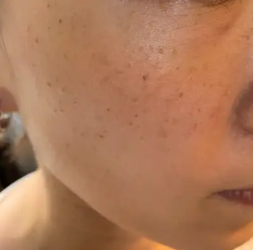 最近發現的居家深層保養好夥伴光透美容面罩