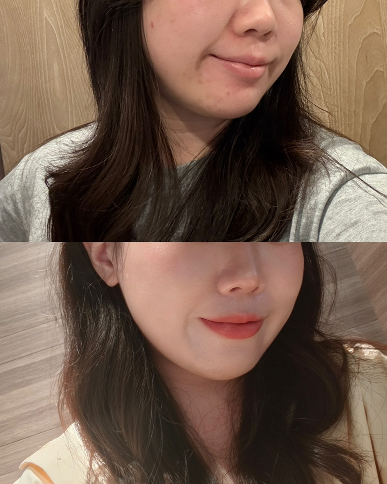 不靠醫美！生活調整＋內服外用改善氣色分享