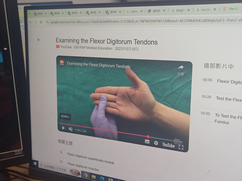 手指復健 Finger Rehabilitation