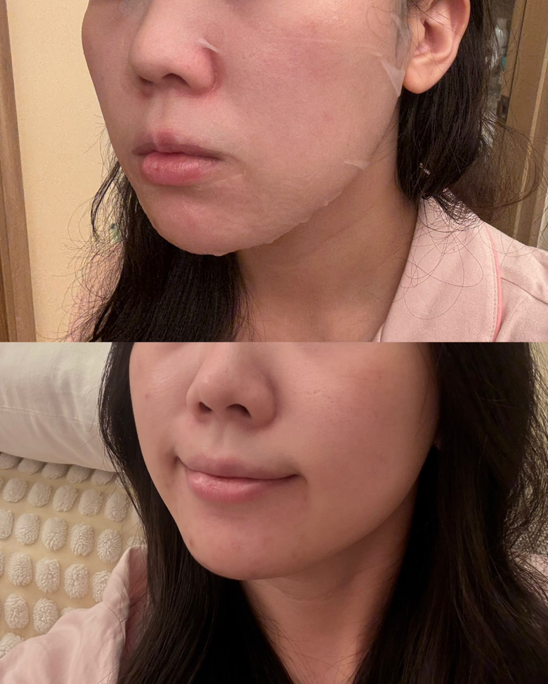 不靠醫美！生活調整＋內服外用改善氣色分享