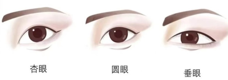 眉眼距離近適合做雙眼皮手術嗎?