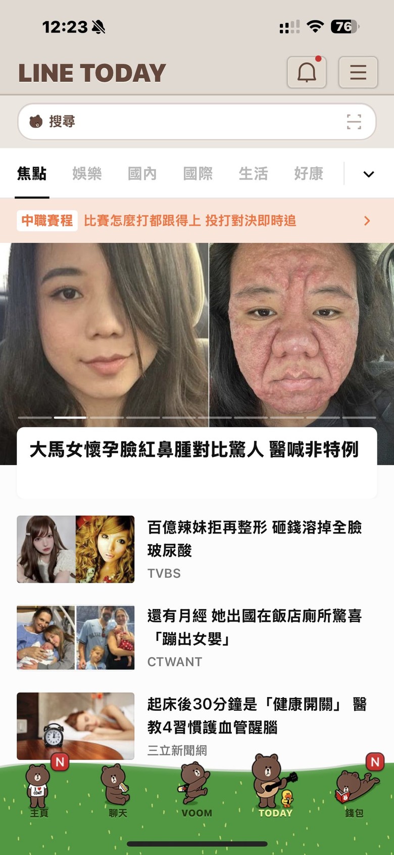 大家看到的Line Today都一樣嗎？