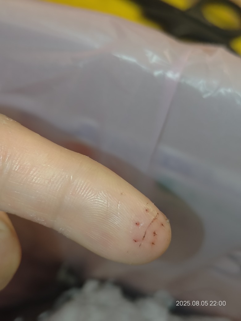 手指復健 Finger Rehabilitation