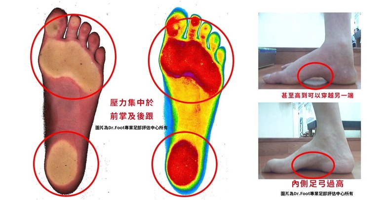 詢問適合長輩穿的鞋