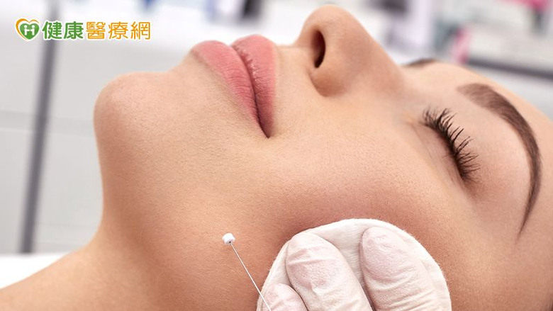 點我看大圖 埋線拉提能逆齡?醫師揭線雕抗老真相