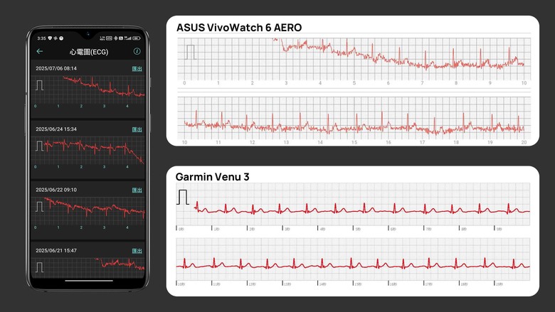 「心得」ASUS VivoWatch 6 AERO - 市面最平價的醫材認證血壓手環？