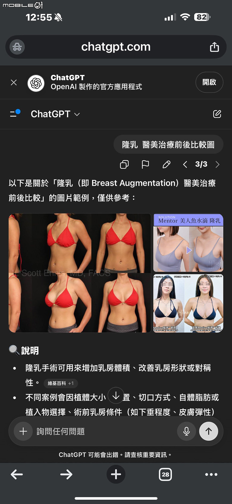 直接在ChatGPT輸入抽脂大腿術前術後比較圖，會發生什麼事？