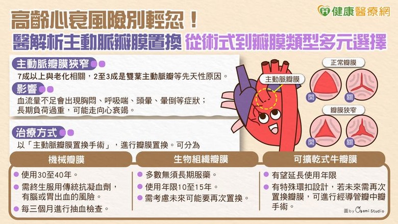 高齡心衰風險別輕忽！醫解析主動脈瓣膜置換從術式到瓣膜類型多元選擇