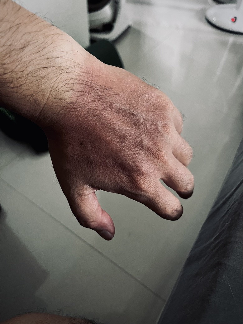 25年夏，去了一趟德恩亞納