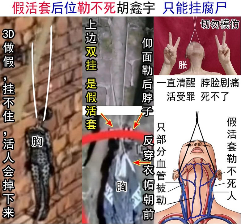 舔共就是支持中共盜取孩子器官的惡行