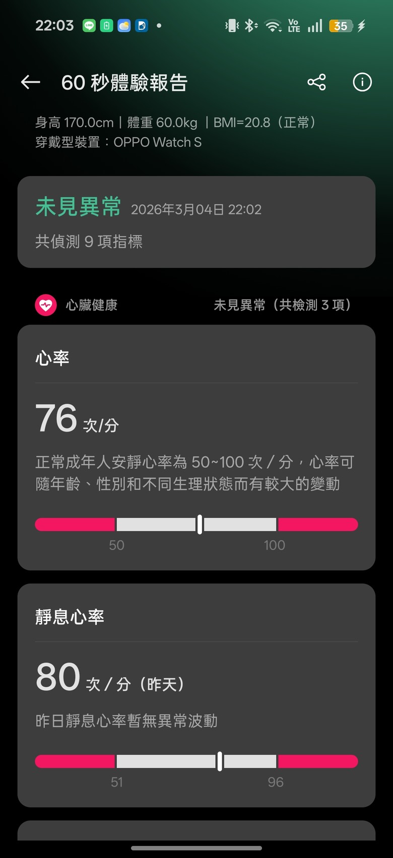 點我看大圖 OPPO Watch S 開箱 |超薄 |輕智能 |60秒全方位快速健檢 -有許多地方需要打磨