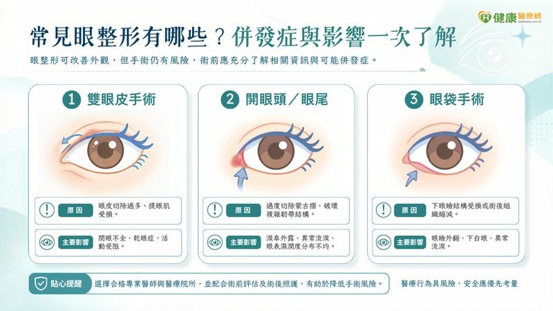 眼整形術後乾眼、閉眼困難？醫說明多元重建對策眼部結構修復是關鍵