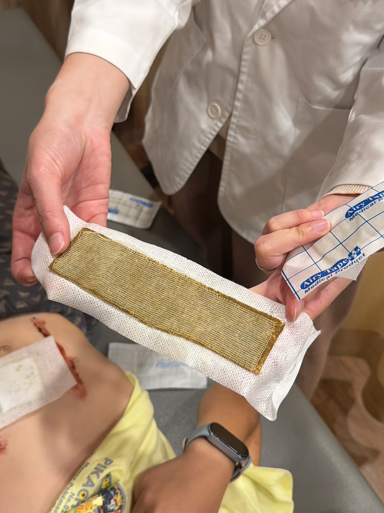 [紀錄] 小一兒子的變身計畫：中藥調理＋三伏貼雙管齊下，終於看見孩子食量大開！