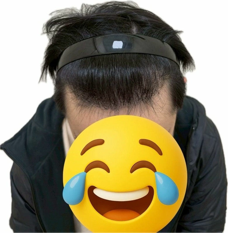 桃園植髮分享