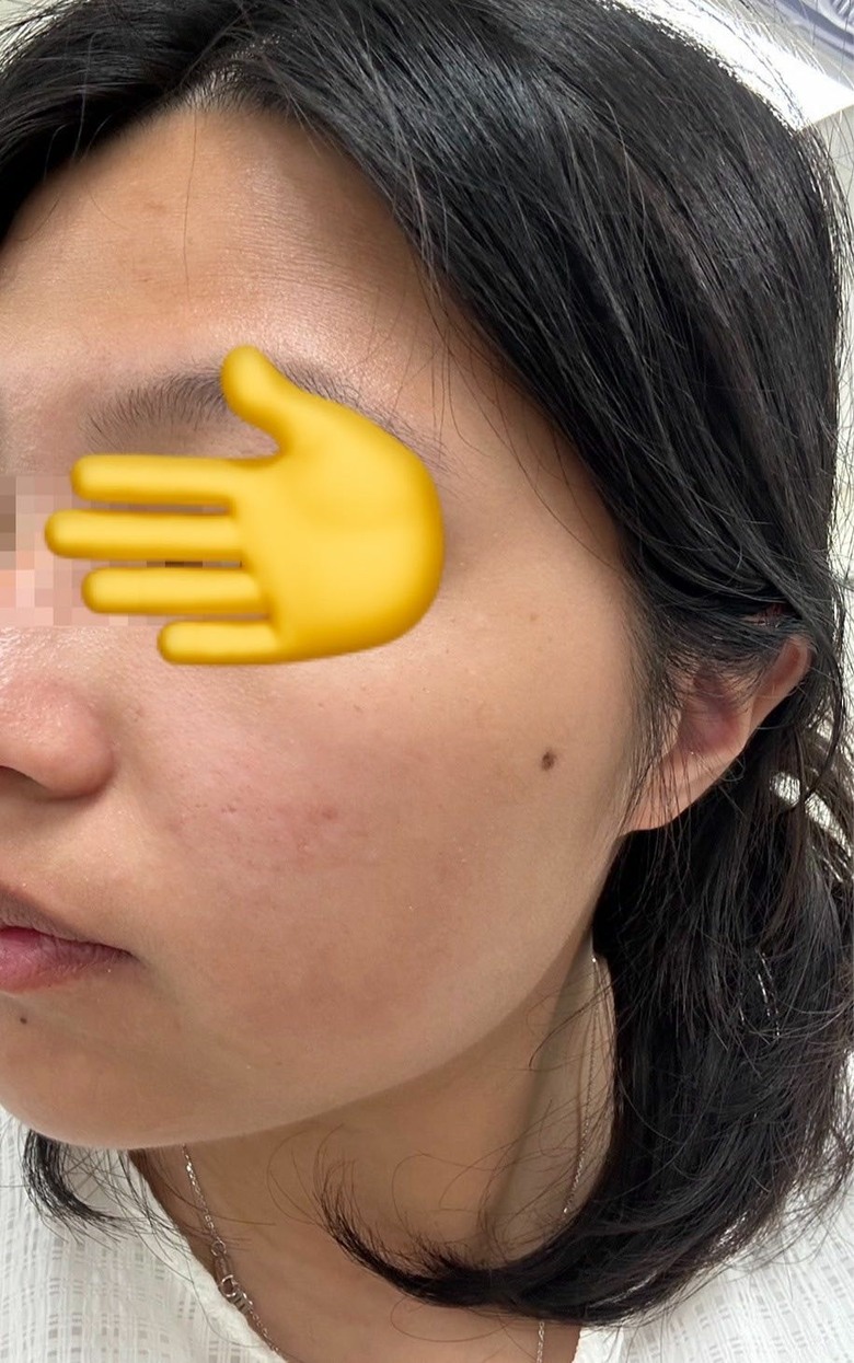 美容面罩效果好嗎？兩個月使用心得
