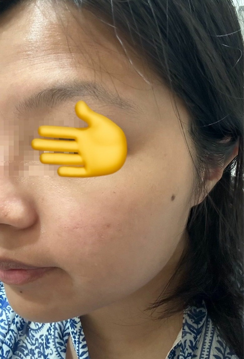 美容面罩效果好嗎？兩個月使用心得