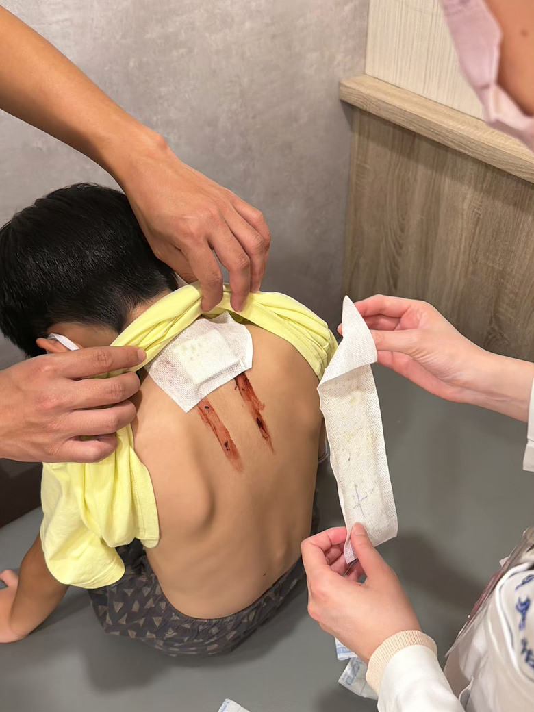 [紀錄] 小一兒子的變身計畫：中藥調理＋三伏貼雙管齊下，終於看見孩子食量大開！