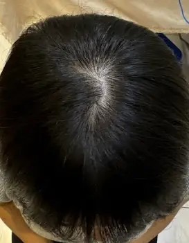 #開箱 本蘊有用嗎?我的30+養髮大作戰...