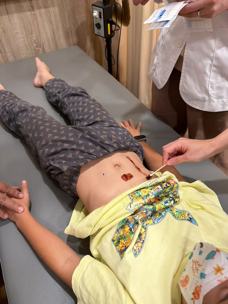 [紀錄] 小一兒子的變身計畫：中藥調理＋三伏貼雙管齊下，終於看見孩子食量大開！