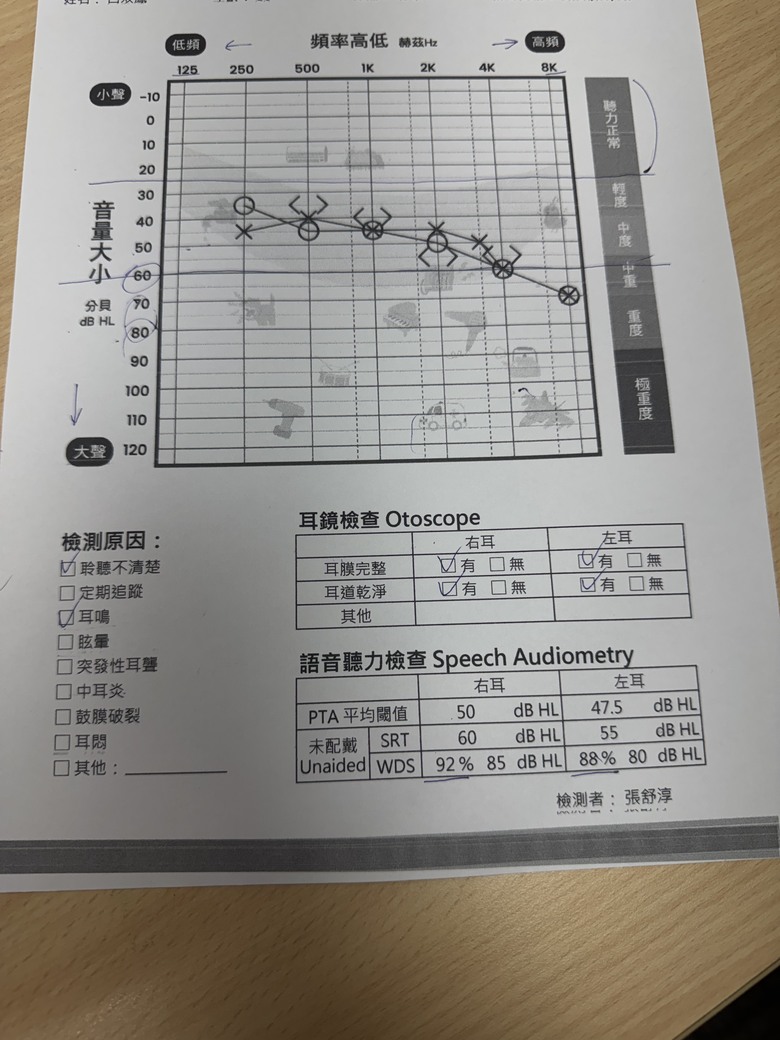 台灣助聽器品牌 XROUND HEAR PRO 虹韻門市試聽心得
