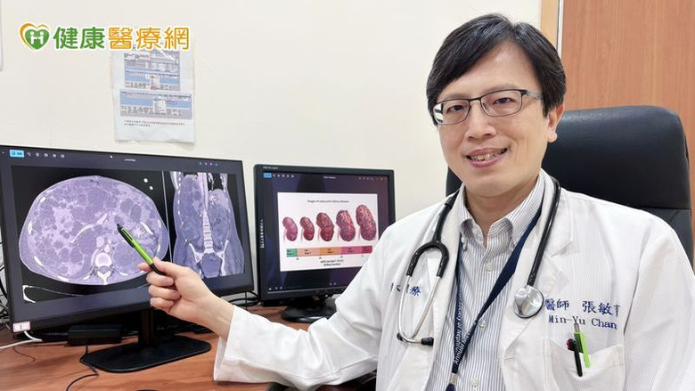 20歲無感10年後竟洗腎？新型口服藥阻多囊腎惡化