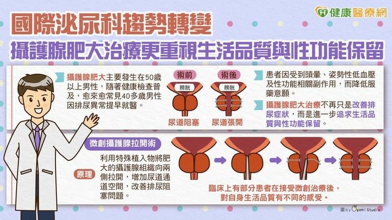 點我看大圖 國際泌尿科趨勢轉變攝護腺肥大治療更重視生活品質與性功能保留