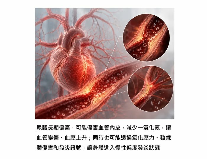尿酸高只有痛風的風險嗎?