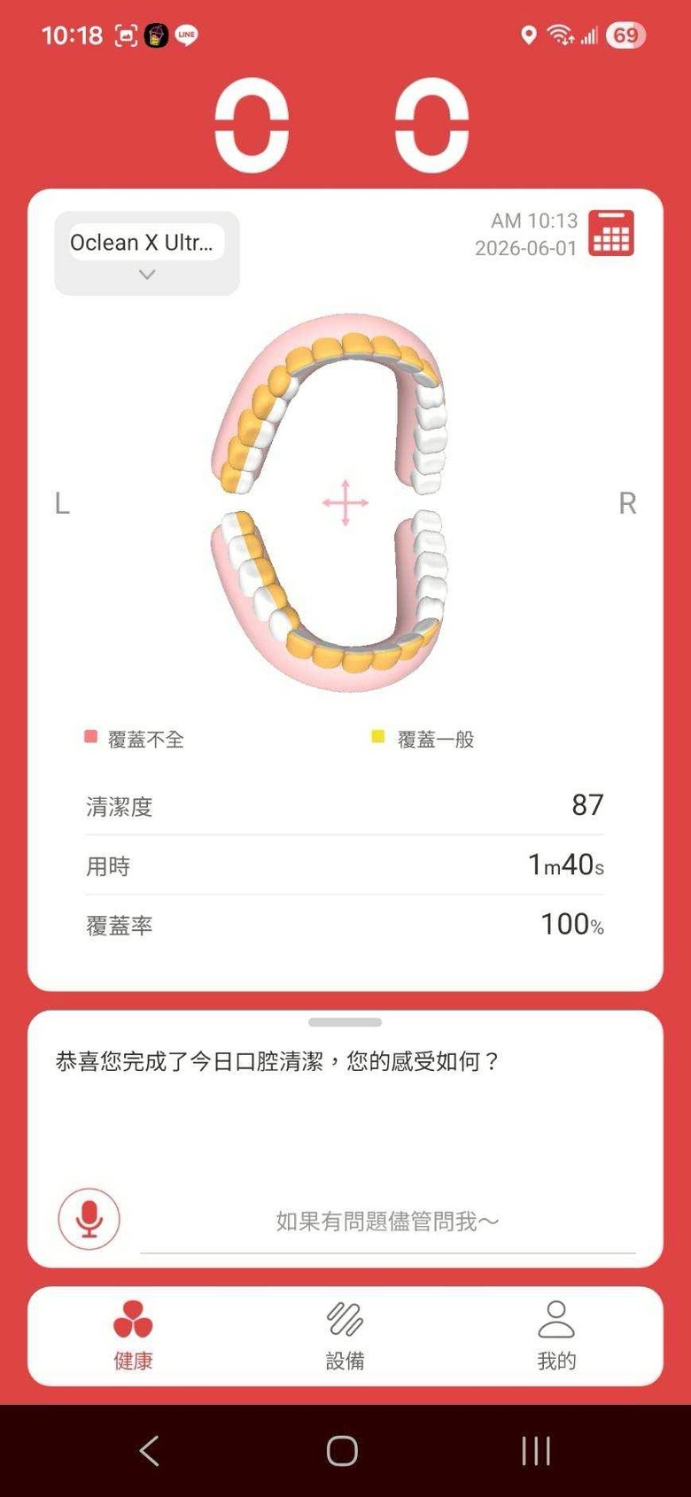 點我看大圖 Oclean X Ultra 20S 開箱使用一個月心得 AI智慧電動牙刷