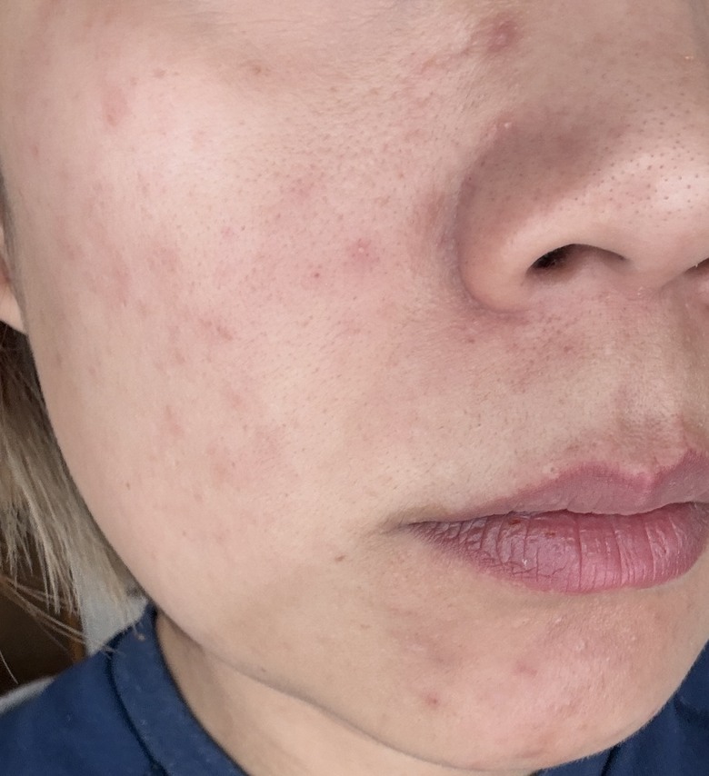 30歲女生膚況變好心得分享