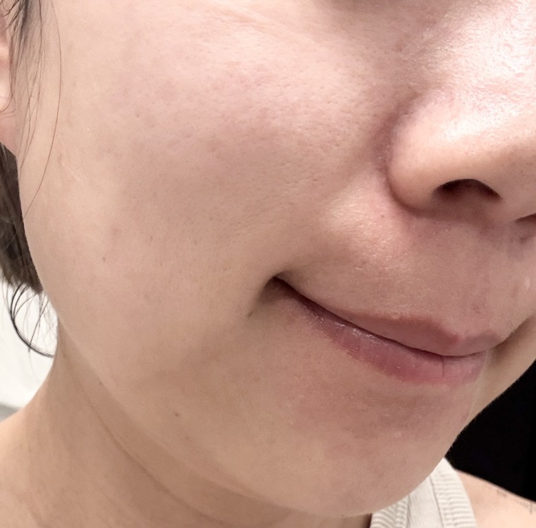 30歲女生膚況變好心得分享